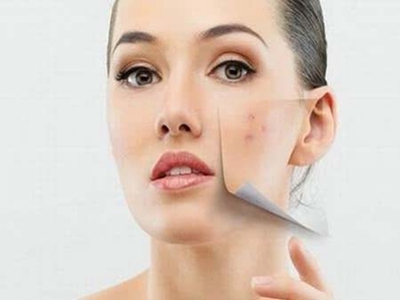 十大瘦脸方法助广州代妈瘦成V字脸