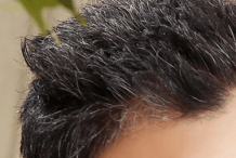 怎样预防头发变白?这些方法很有效