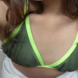 假体隆胸前后对比照,效果喜人