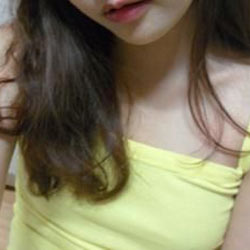 假体隆胸前后对比照,效果喜人