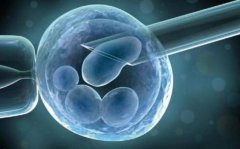 做试管压力大？教你几招轻松缓解，成功